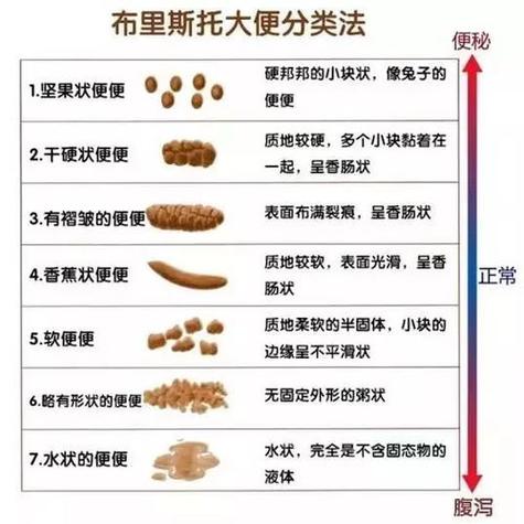 旅游多久不拉屎正常-旅游好几天不大便什么原因