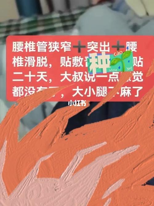 腰脱多久能旅游-腰脱好了多久可以跑步